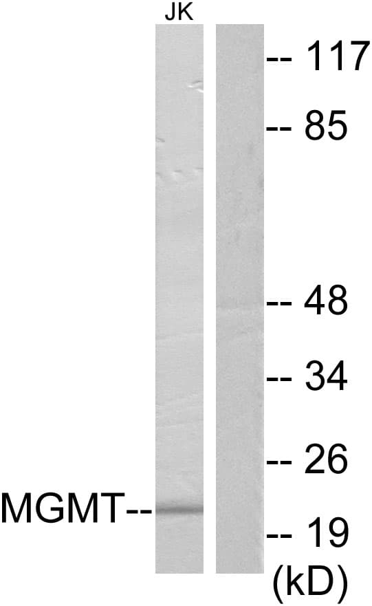 MGMT Antibody (aa1-50)