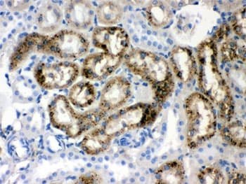 Polyclonal Rabbit anti-Mouse TTR / Transthyretin Antibody (IHC, WB)
