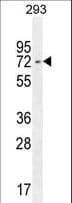 Polyclonal Rabbit anti-Human IRF2BP2 Antibody (aa337-366, WB)