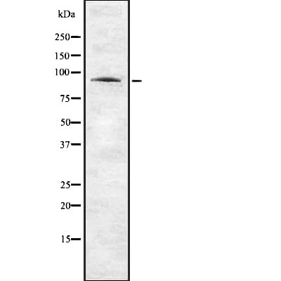 ANO1 / DOG1 / TMEM16A Antibody