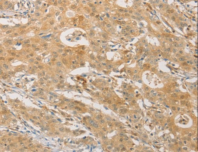 PGK2 Antibody
