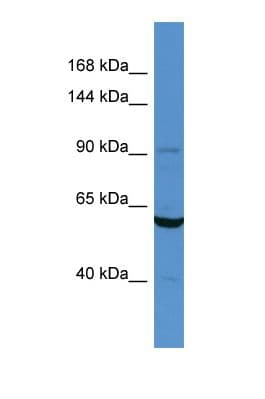 CARS1 / CARS Antibody (N-Terminus)