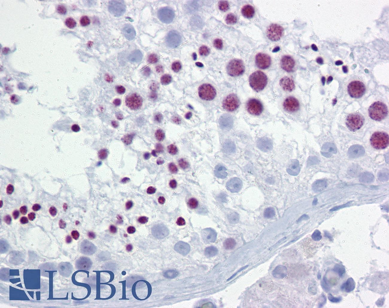 BRD3 Antibody (aa648-697)