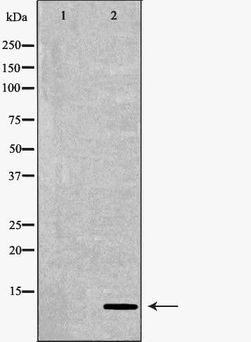 S100B / S100 Beta Antibody