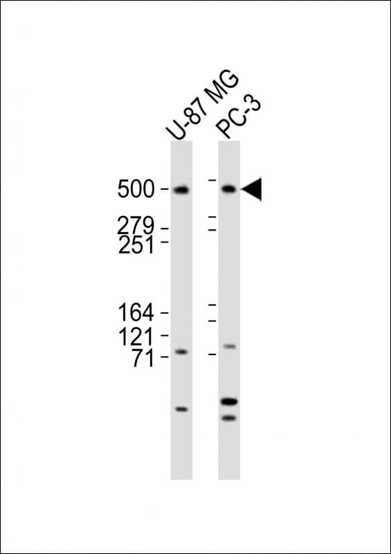 Polyclonal Rabbit anti-Human DYNC1H1 Antibody (aa4202-4236, WB)