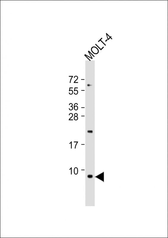 Polyclonal Rabbit anti-Human GNG5 Antibody (C-Terminus, WB)