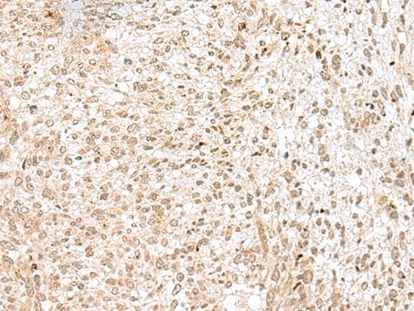 NGEF / EPHEXIN Antibody
