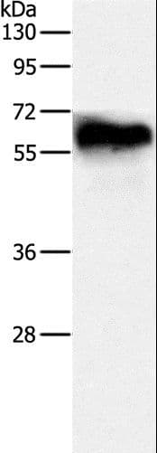 Polyclonal Rabbit anti-Human DPYSL4 / CRMP3 Antibody (WB)