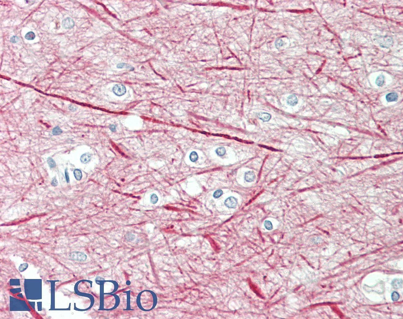 PathPlus™ NEFM / NF-M Antibody (aa250-263)