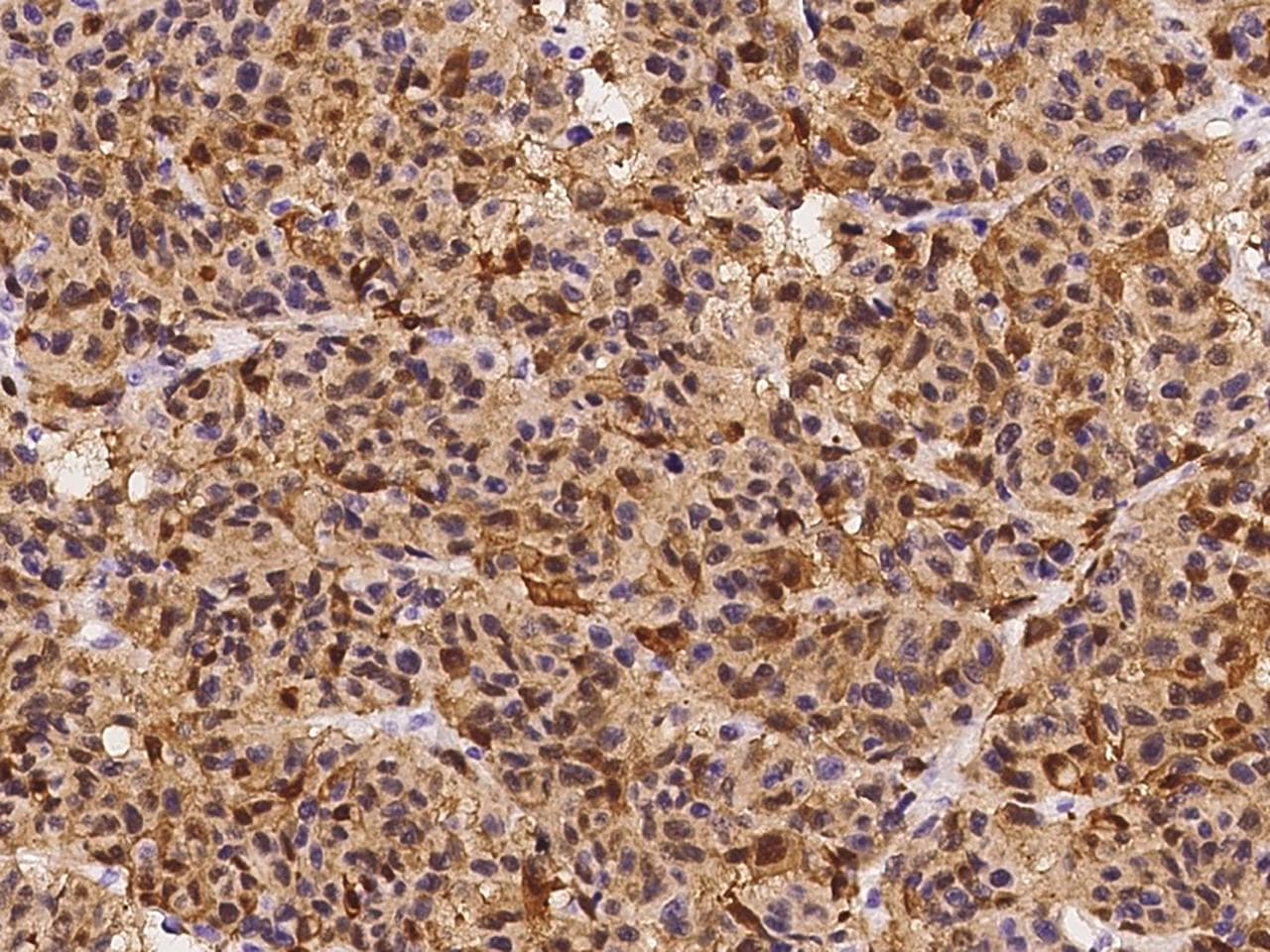 Monoclonal Rabbit anti-Human S100B / S100 Beta Antibody (clone 244, Preservative Free, IHC, IF)