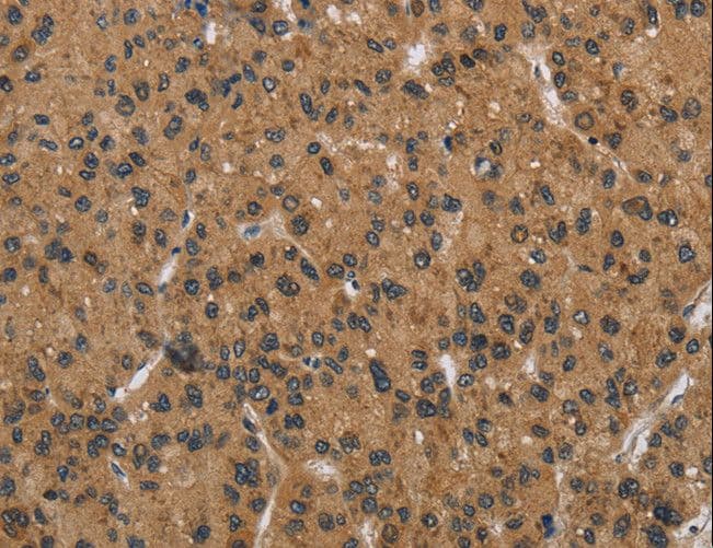 Polyclonal Rabbit anti-Human DNAJA1 / HDJ2 Antibody (IHC, WB)