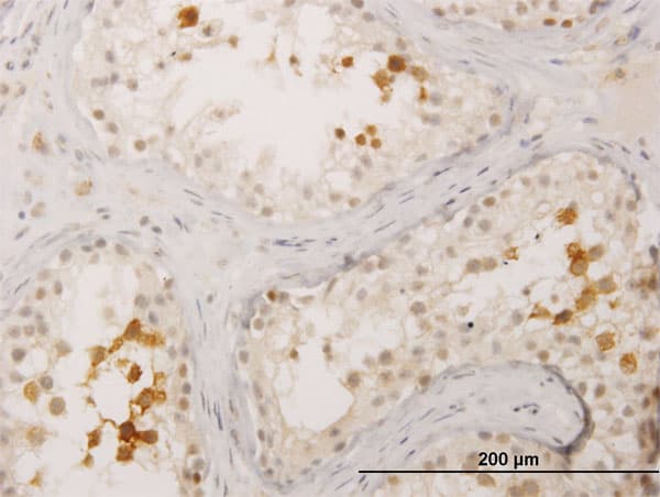 Monoclonal Mouse anti-Human BOULE / BOLL Antibody (clone 3E10, IHC, WB)