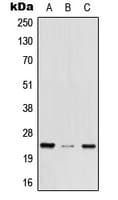 Polyclonal Rabbit anti-Human MED29 / IXL Antibody (Internal, WB)