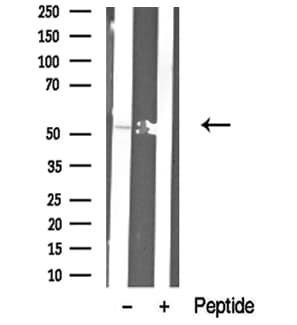 SMAD1 Antibody