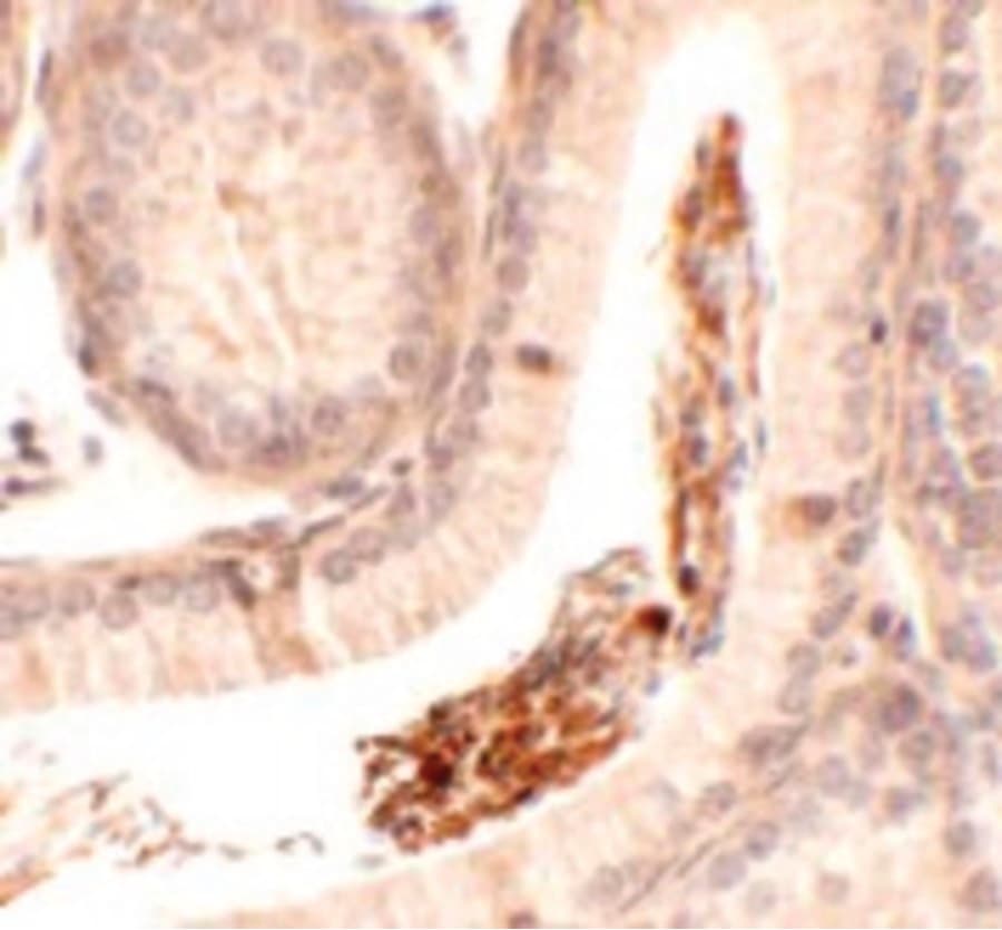 SP-2 / SPATA1 Antibody