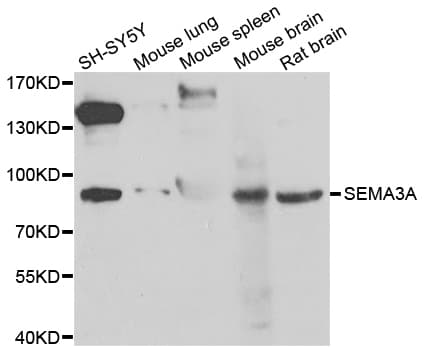 SEMA3A / Semaphorin 3A Antibody
