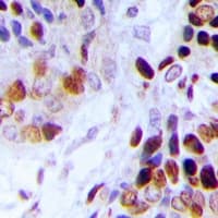 AK6 / Adenylate Kinase 6 Antibody (N-Terminus)