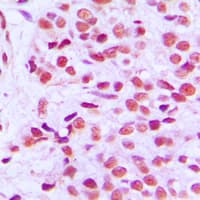 ETS1 / ETS-1 Antibody (phospho-Thr38)
