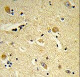 CDIPT Antibody (aa99-125)