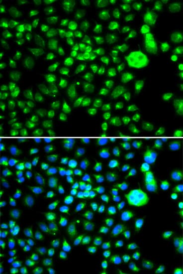 Polyclonal Rabbit anti-Human SMCHD1 Antibody (IHC, IF, WB)
