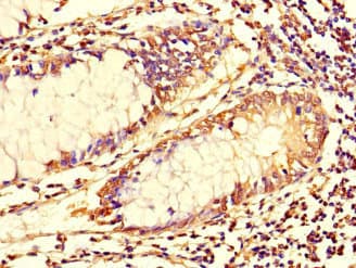 TUBG1 / Tubulin Gamma 1 Antibody