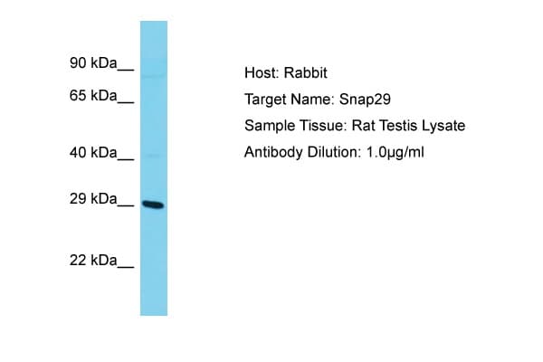 SNAP29 Antibody (aa141-190)
