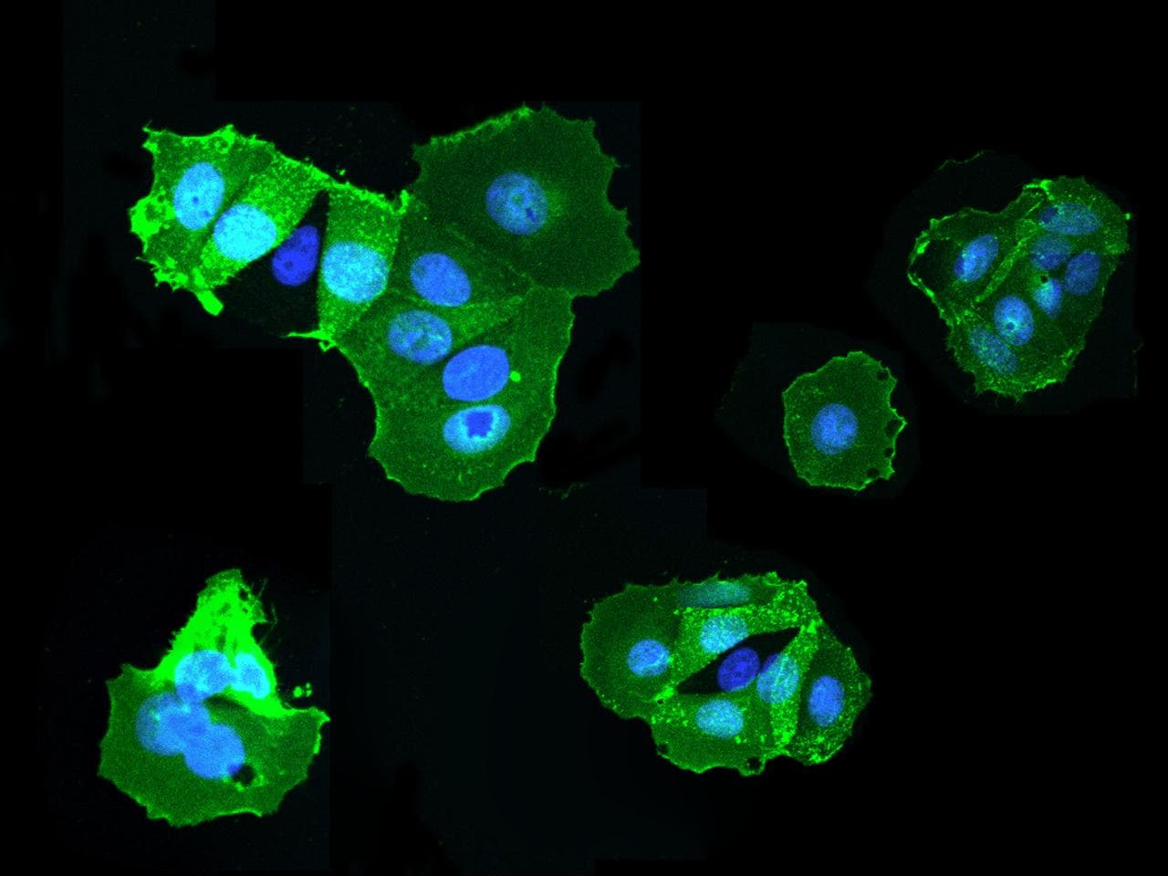 Polyclonal Rabbit anti-Human CD98 Antibody (Preservative Free, aa206-630, IHC, IF, WB)