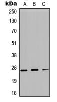 KLK4 / Kallikrein 4 Antibody (N-Terminus)