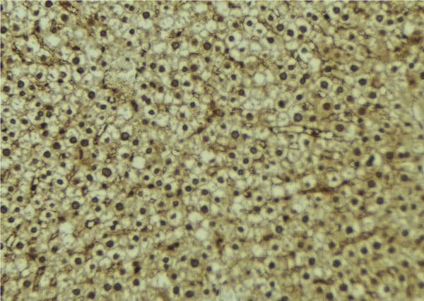 Polyclonal Rabbit anti-Human CPS1 Antibody (IHC, IF, WB)