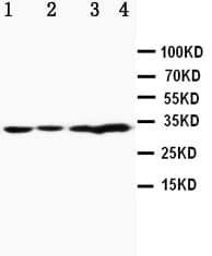 APOD / Apolipoprotein D Antibody (aa172-189)