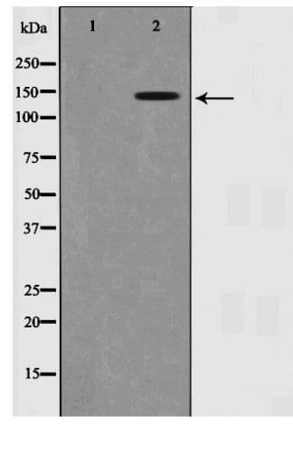 Polyclonal Rabbit anti-Human SMC1A / SMC1 Antibody (phospho-Ser957, IHC, WB)