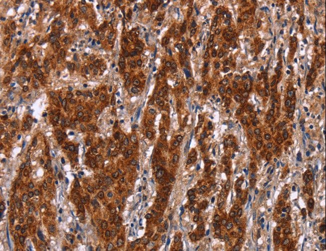 GCKR Antibody