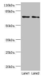 Polyclonal Rabbit anti-Human MAGEC3 Antibody (WB)
