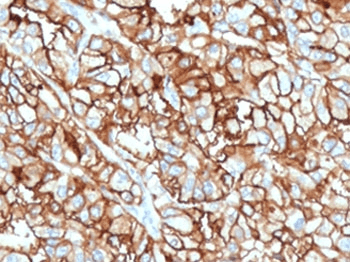 Monoclonal Mouse anti-Human MME / CD10 Antibody (clone CDLA10-1, IHC, WB)
