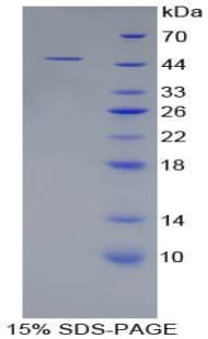 Rat NRP1 / Neuropilin 1 Protein (Recombinant His-GST)