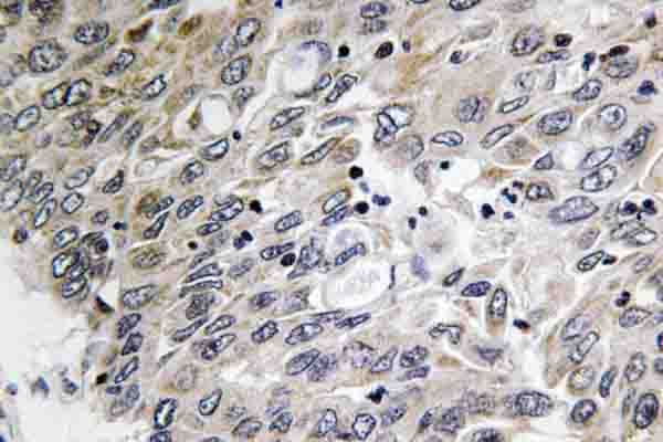 Polyclonal Rabbit anti-Human C1QG / Complement C1QC Antibody (Gln119, IHC, WB)