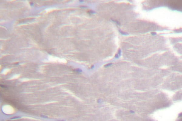 IKK Alpha+Beta Antibody (Asp173)