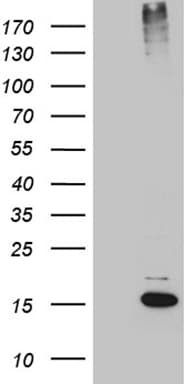 SUMO1 / SMT3 Antibody (clone OTI2B3)