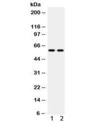 Polyclonal Rabbit anti-Human Tyrosine Hydroxylase Antibody (IHC, WB)