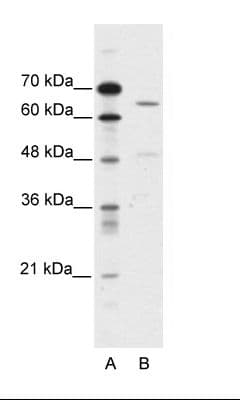 Polyclonal Rabbit anti-Human ACCN1 / ASIC2 Antibody (aa481-530, IHC, WB)