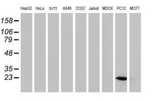 HSPB8 / H11 / HSP22 Antibody (clone OTI1E3)