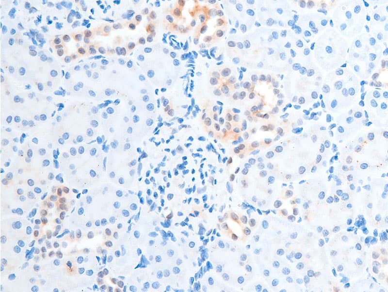 CHEK2 / CHK2 Antibody (phospho-Thr387)