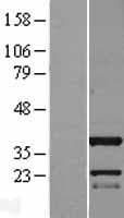 C11orf49 Protein (Over-Expression Lysate Myc-DDK (Flag))