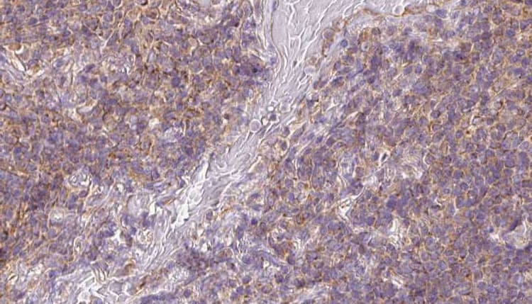 Polyclonal Rabbit anti-Human SDC3 / Syndecan 3 Antibody (IHC, IF, WB)