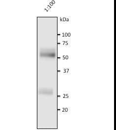 Polyclonal Goat Anti-Human IgG Secondary Antibody (WB)