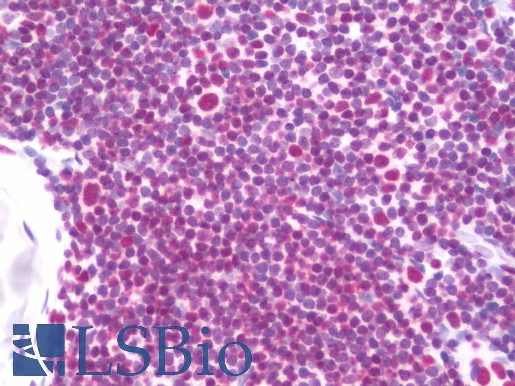 IHC-plus™ p16INK4a / CDKN2A Antibody (clone 5A8A4,3G8D12)