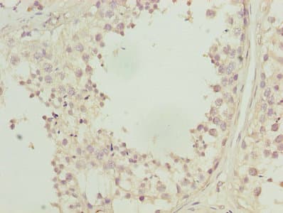 CA3 / Carbonic Anhydrase III Antibody