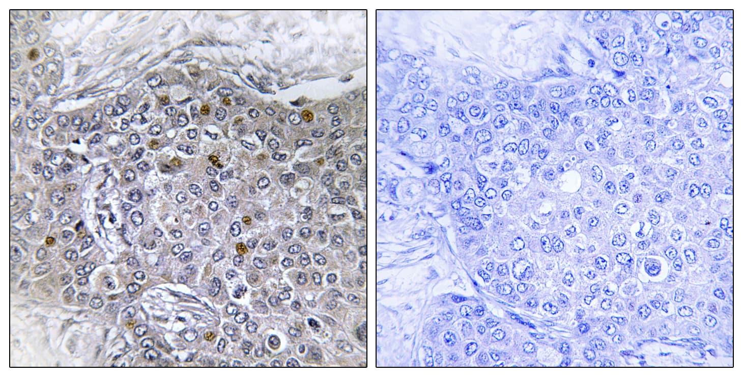ZMYND11 / BS69 Antibody (aa111-160)