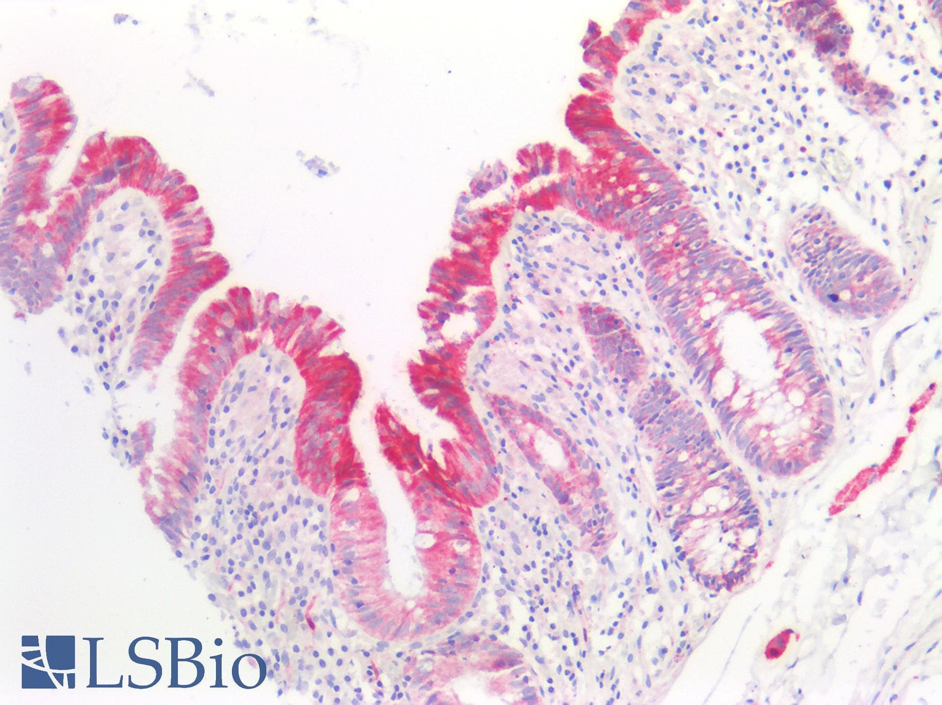 PathPlus™ Polyclonal Rabbit anti-Human BMP6 Antibody (IHC, WB)