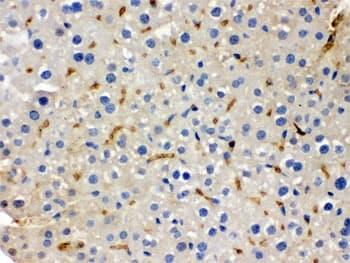 BMP5 Antibody